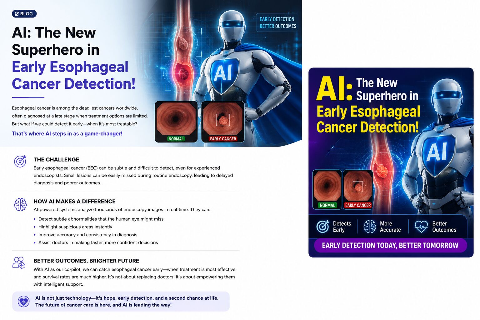 ai-the-new-superhero-in-early-esophageal-cancer-detection-image